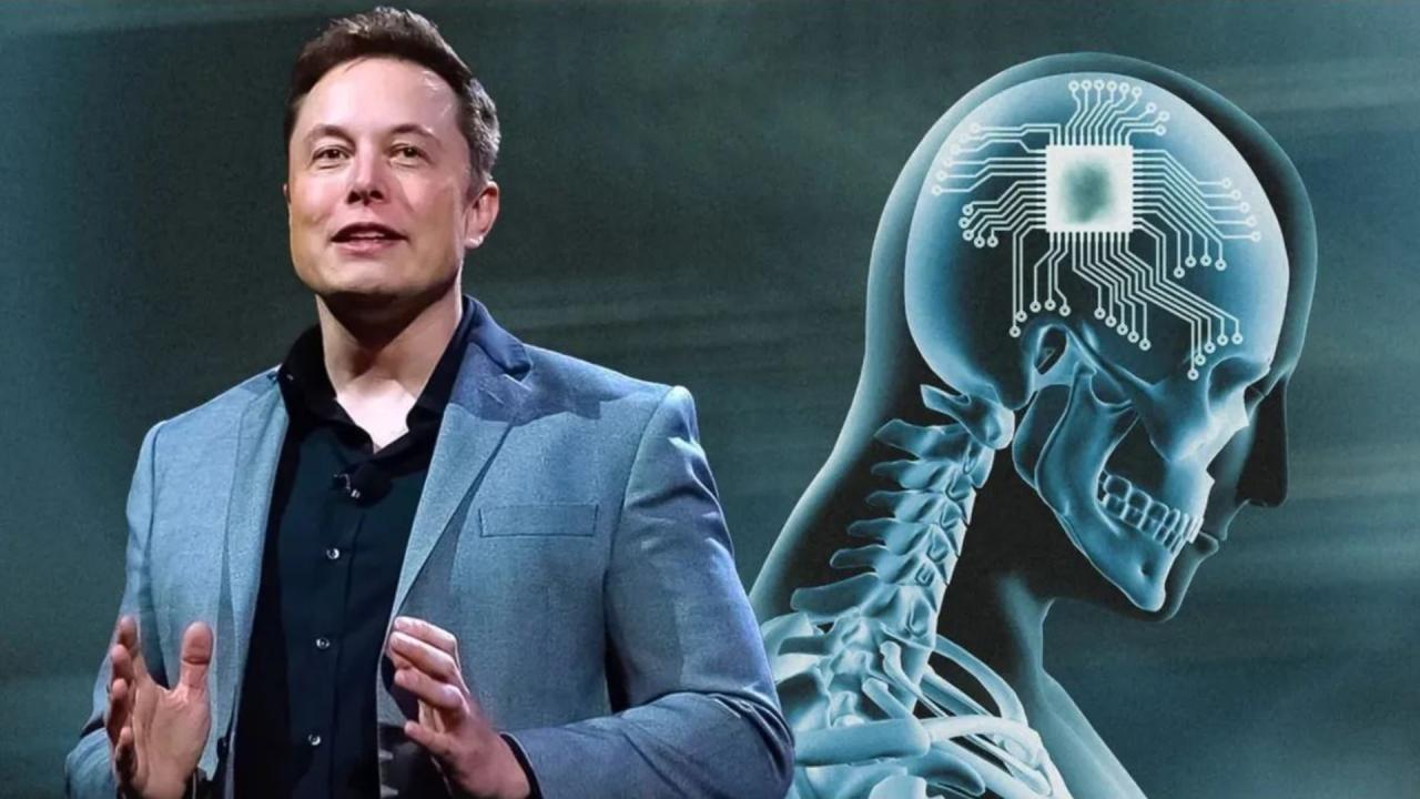 Elon Musk's brain chip to help blind people see gets approval